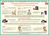 Таблица "Порядок действий при опасном кровотечении" (100х140 сантиметров, винил) - fgospostavki.ru - Семёнов